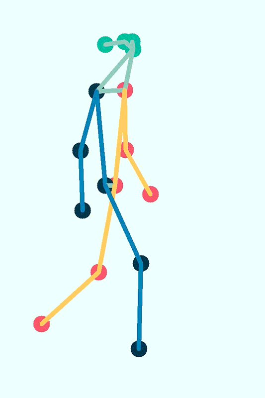 A pose-mapping technique could remotely evaluate patients with cerebral palsy
